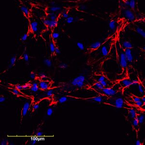 An image of PEG-FUD-Cy5 (shown in red) bound to extracellular matrix fibronectin assembled by fibroblasts that are growing on a glass slide (blue spheres in the photo).